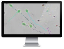Методика SPERM анализов сперматозоидов